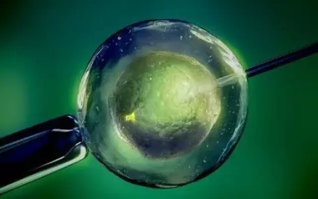体外受精 IVF-ET